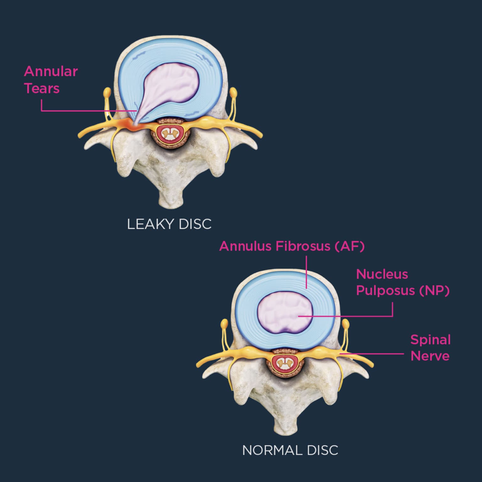 Total Management non-surgical spine care